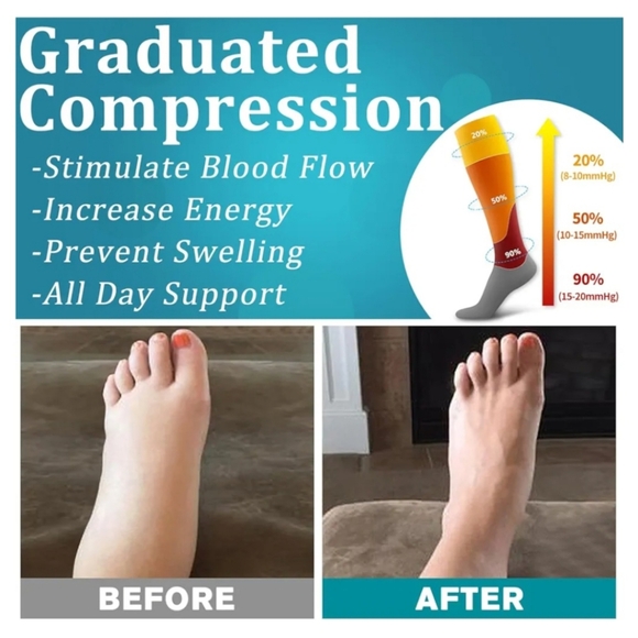 Compression Socks - Picture 7 of 7